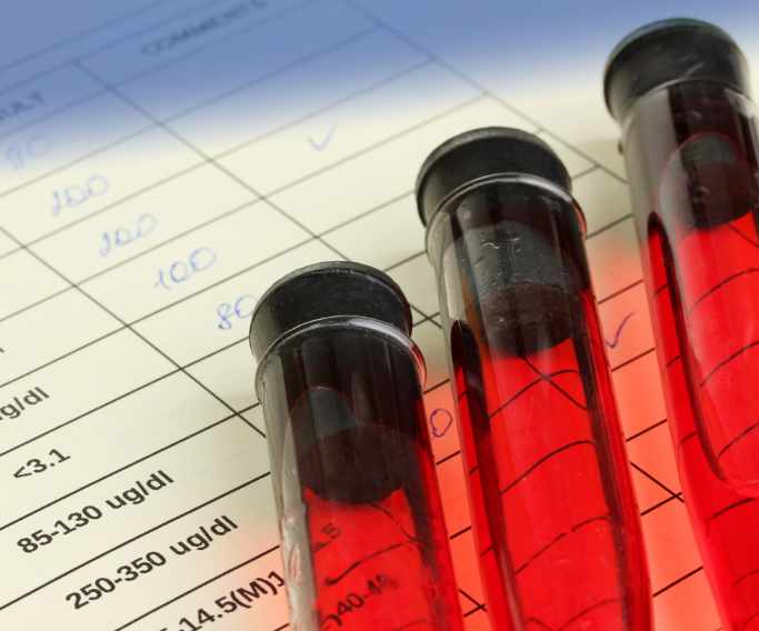 Biospecimen Management ACM Allied Clinical Management